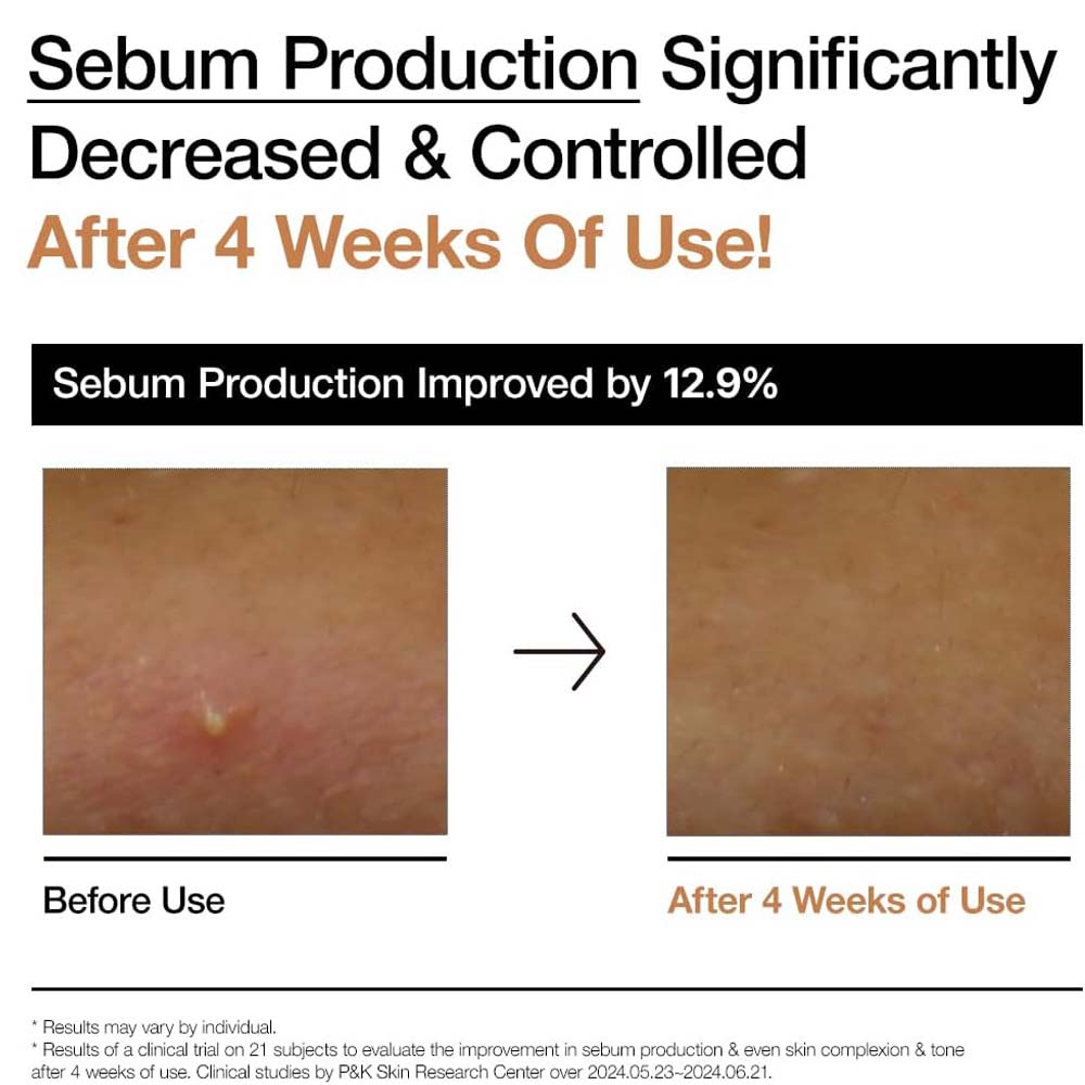 ANUA Rice 70 Grow Milky Toner 250ml - Korean Moisturizing Lotion for Brightening, Hydration & Smooth Skin Tone Image