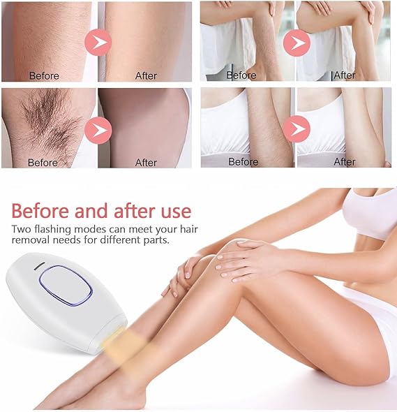 Home Use IPL Beauty Device – Permanent Hair Removal for Whole Body, Painless Laser Hair Removal Device for Women and Men Image