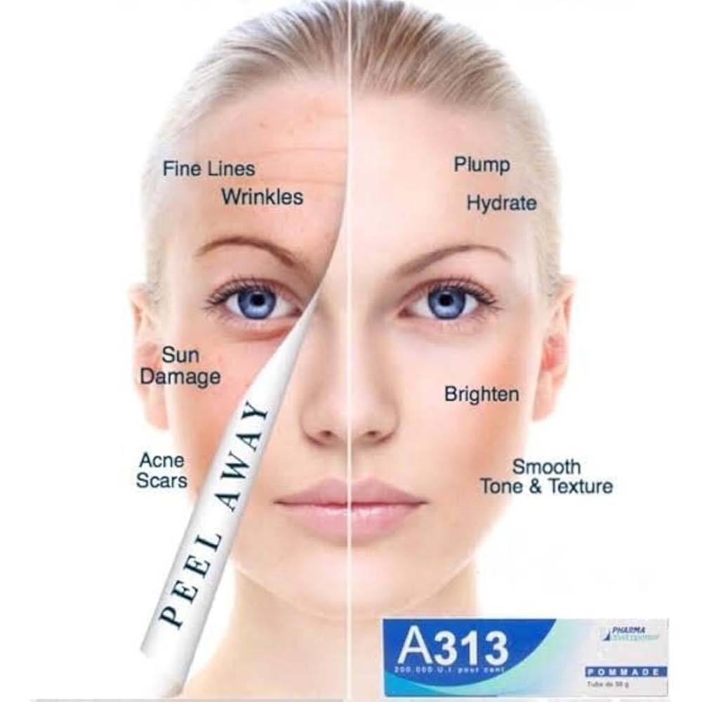 A313 Vitamin A Pommade. French pharmaceutical retinoid ointment for anti-aging, wrinkles & skin renewal. 50g tube. Image