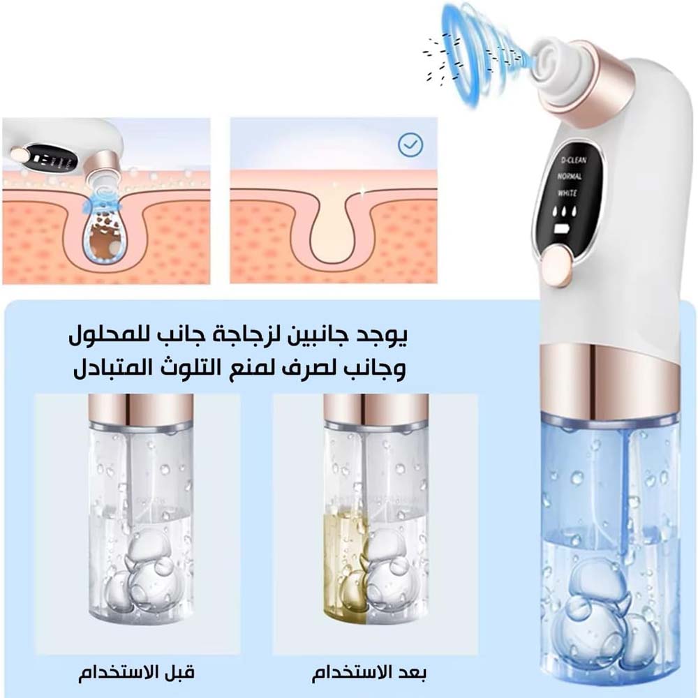 Blackhead Suction Remover Vacuum Pore Cleaner. Electric facial tool for deep cleaning blackheads & unclogging pores. Waterproof. Image