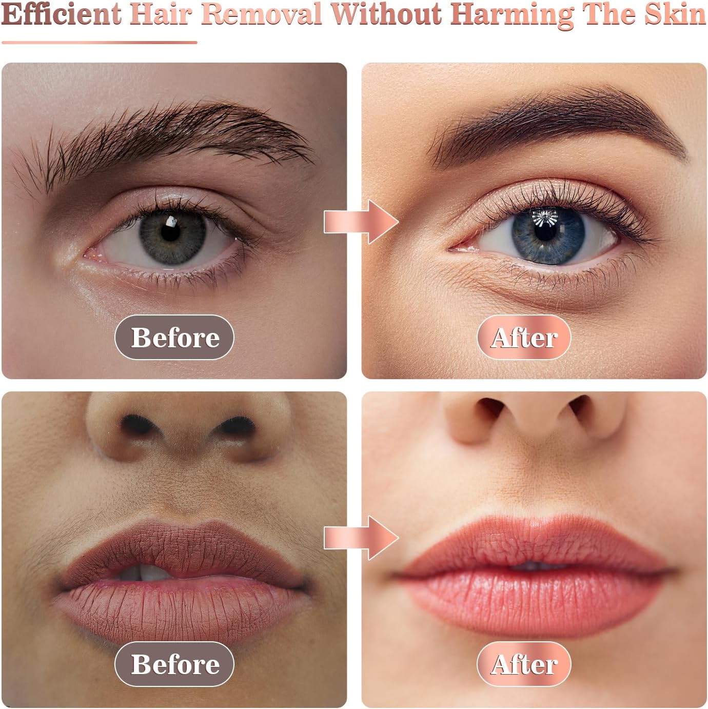 Flawbless Facial Hair Remover for Women – Elegance Meets Efficiency Image