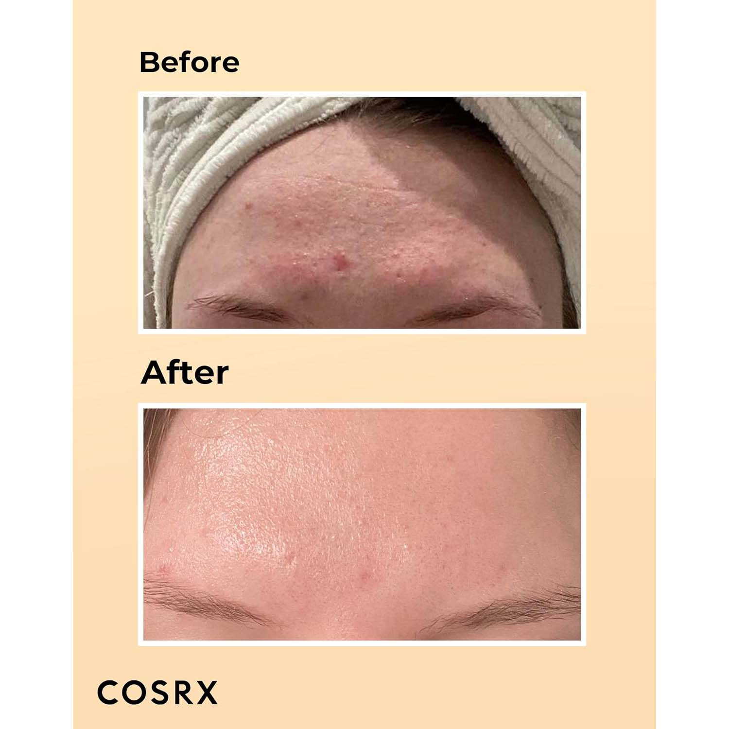 COSRX Advanced Snail 96 Mucin Power Essence. Hydrating & repairing snail secretion filtrate for plump, glowing skin. 100ml. Image