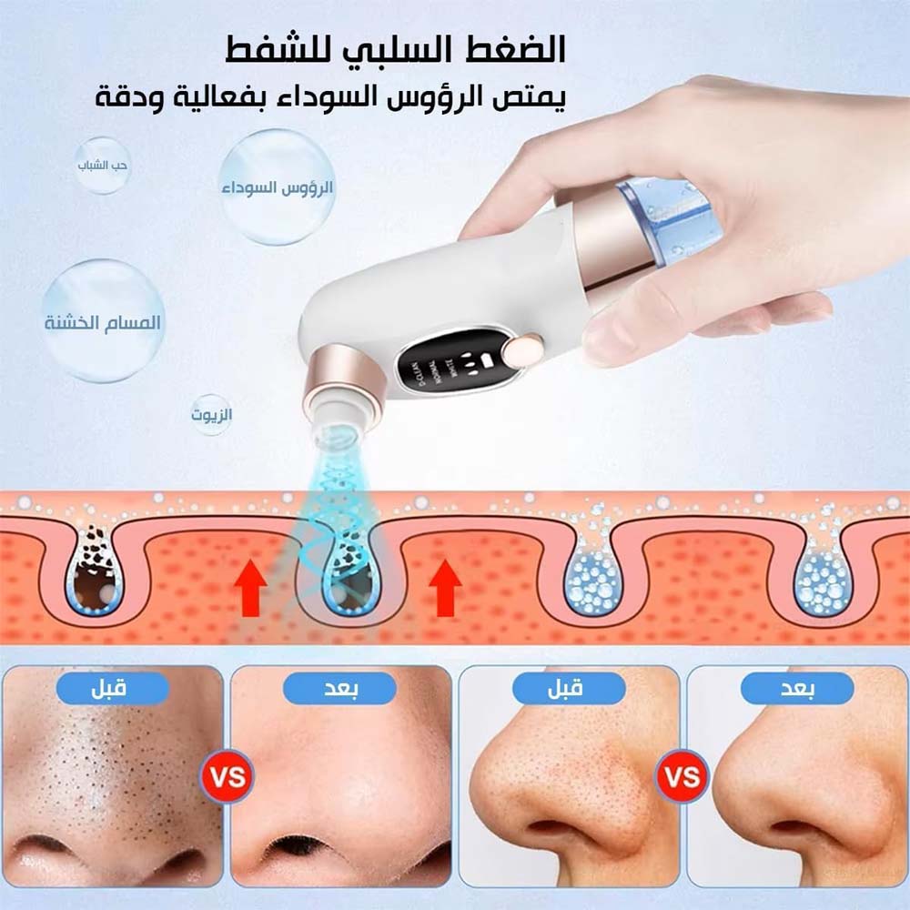 Blackhead Suction Remover Vacuum Pore Cleaner. Electric facial tool for deep cleaning blackheads & unclogging pores. Waterproof. Image