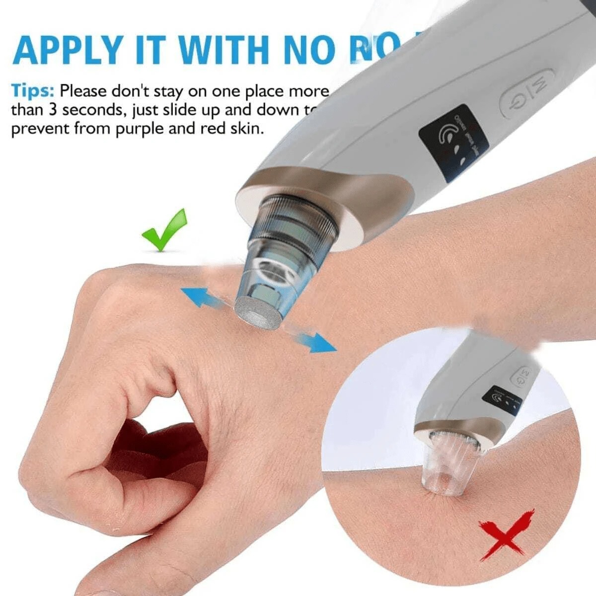 Electric Blackhead Vacuum Remover - Pore Cleanser & Pimple Sucker for Spa-Quality Facial at Home Image