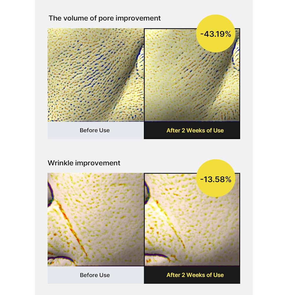 THE VITA-A Retinol Shot Tightening Serum. Potent anti-aging treatment for wrinkles, firmness & skin renewal. 30ml. Image