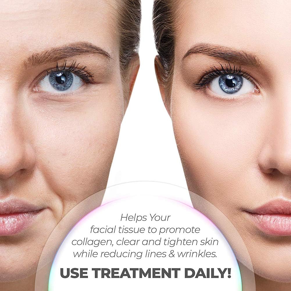 7-LED Whitening Face Mask | Advanced Optical Therapy for Radiant Skin | White/Black | 230x200mm Image