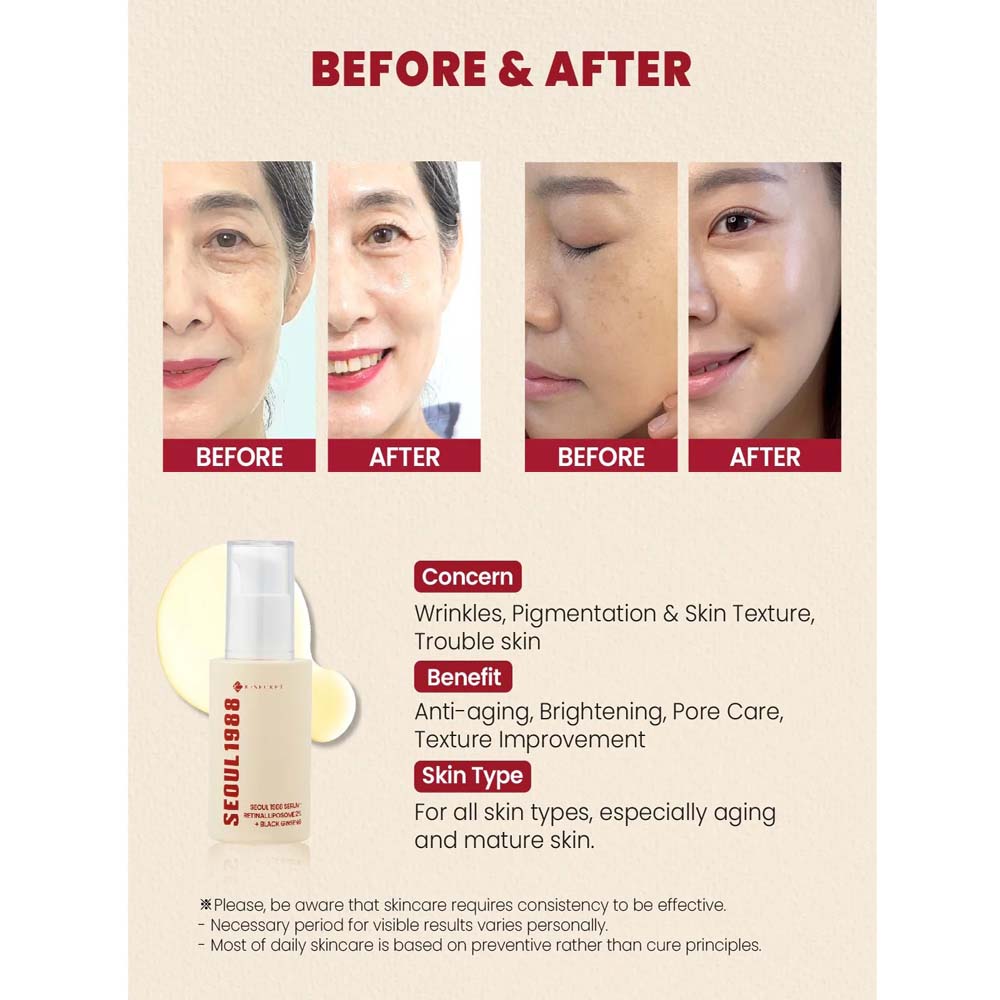 K-Secret SEOUL 1988 Serum with Retinal Liposome 2% & Black Ginseng – Anti-Aging, Wrinkle Care, Brightening & Firming Korean Face Serum 30ml Image