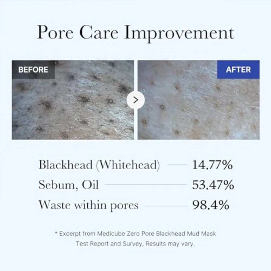 Zero Pore Black Mud Facial Mask - 3-Minute Cooling Pore Tightening with AHA/BHA/PHA, PorePurifying Clay Formula Image