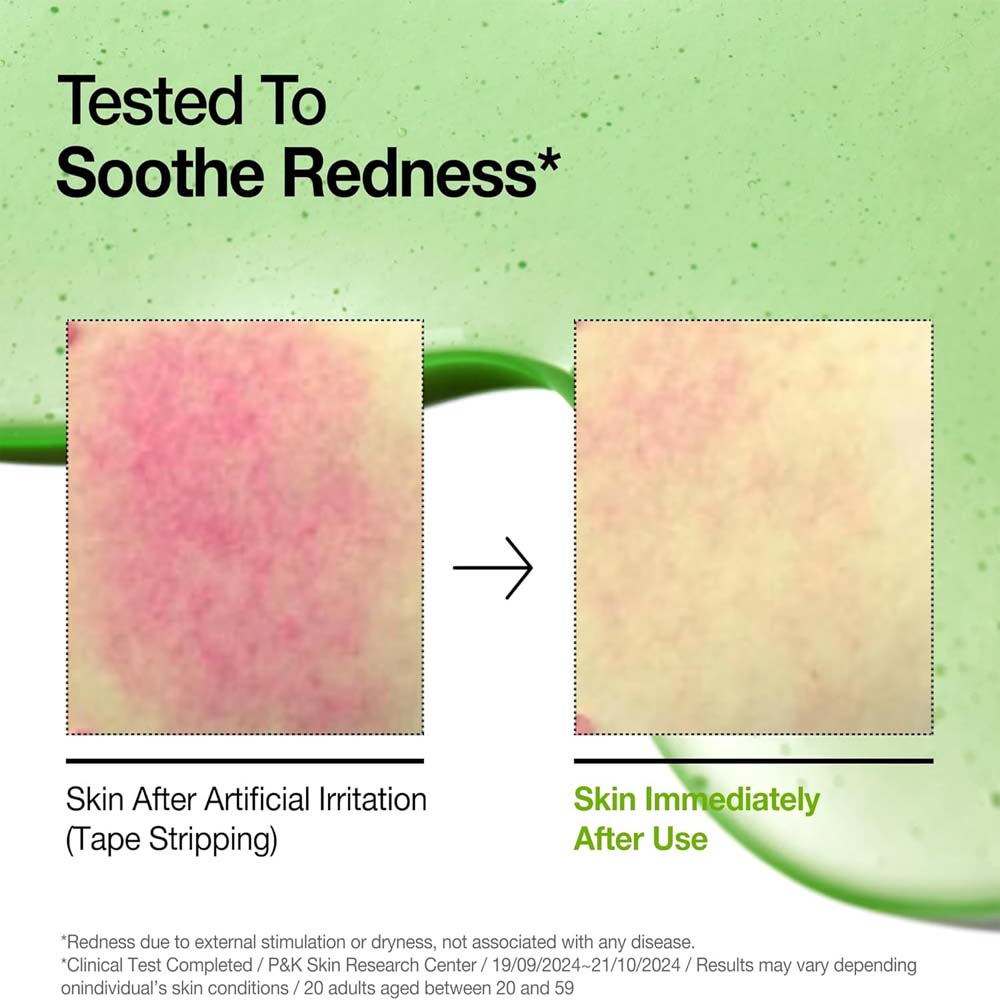 Anua Azelaic Acid 10 Soothing Serum with Hyaluronic Acid & Niacinamide for redness-prone, sensitive skin. Vegan Korean skincare. Image